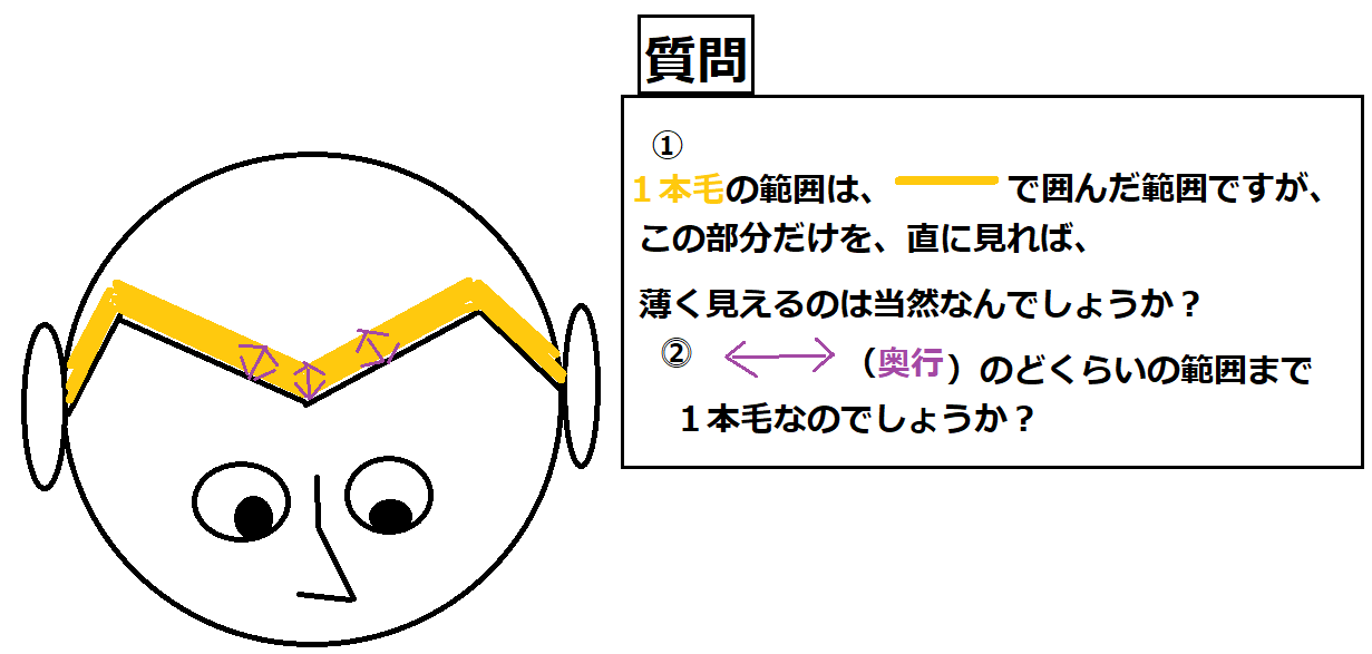 生え際が一本毛なので見え方として薄く見えやすいのか？をお聞きしたいです。