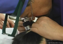 今川院長は植毛の手術を年間500件以上行なっています。